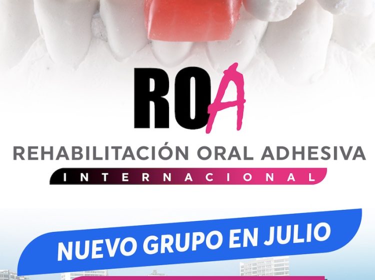 ROA INTERNACIONAL : CURSO TODO INCLUIDO PARA EXTRANJEROS.